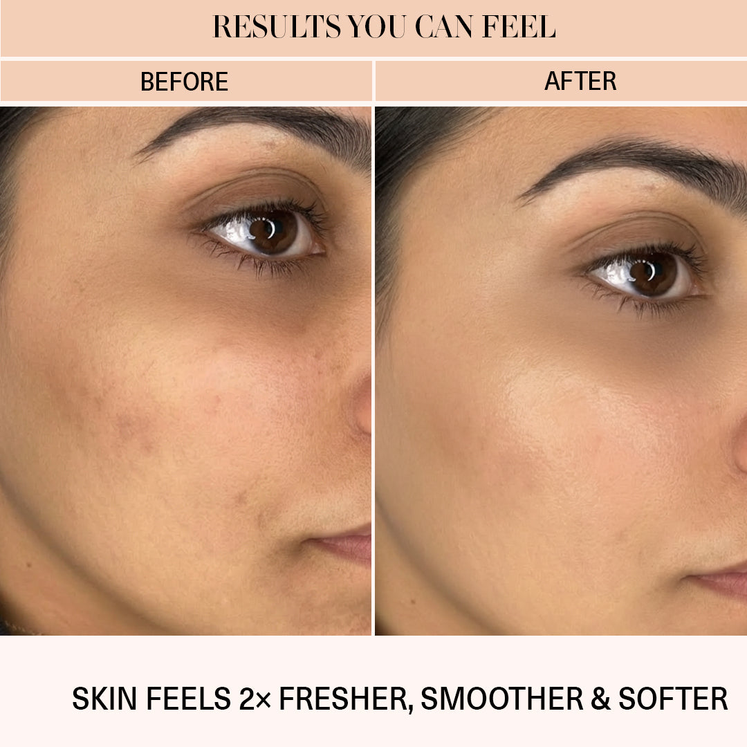 Fresh Forward- Deep Hydrating Cleanser | 50ml