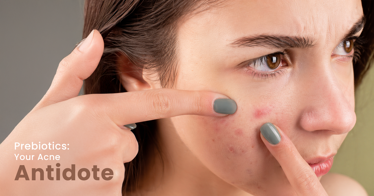 how to prevent acne​