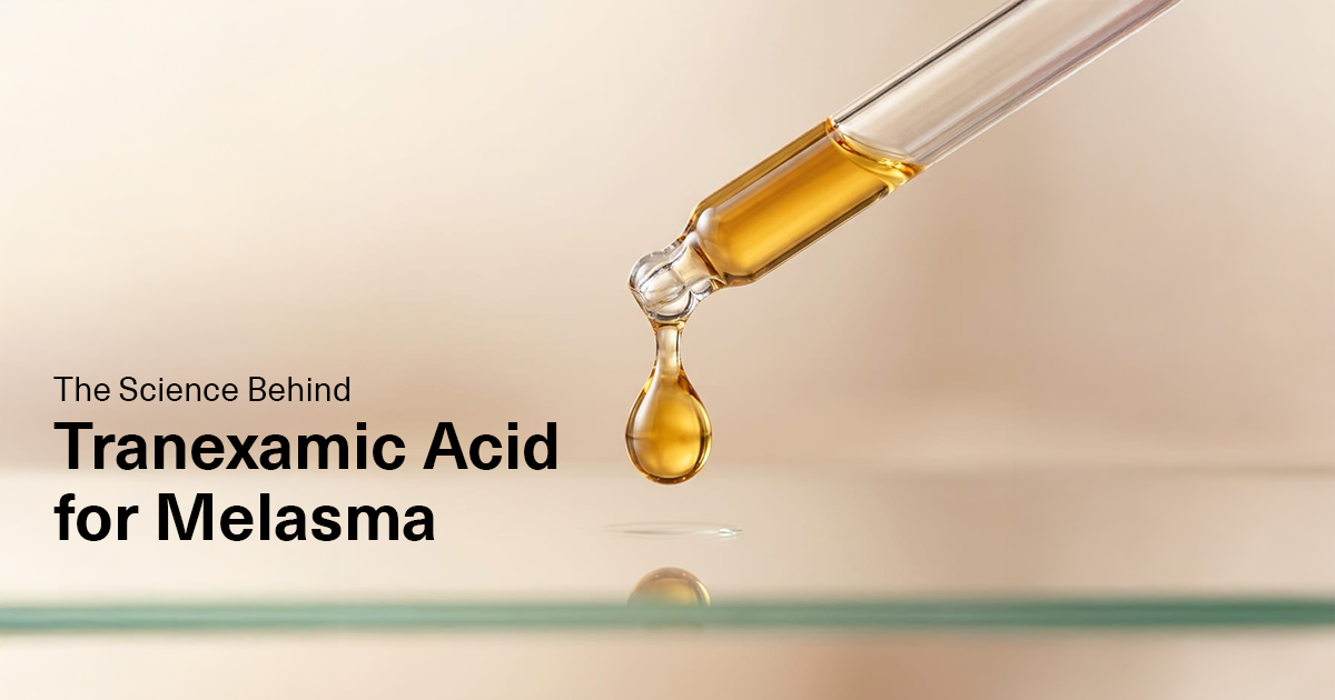 tranexamic acid melasma