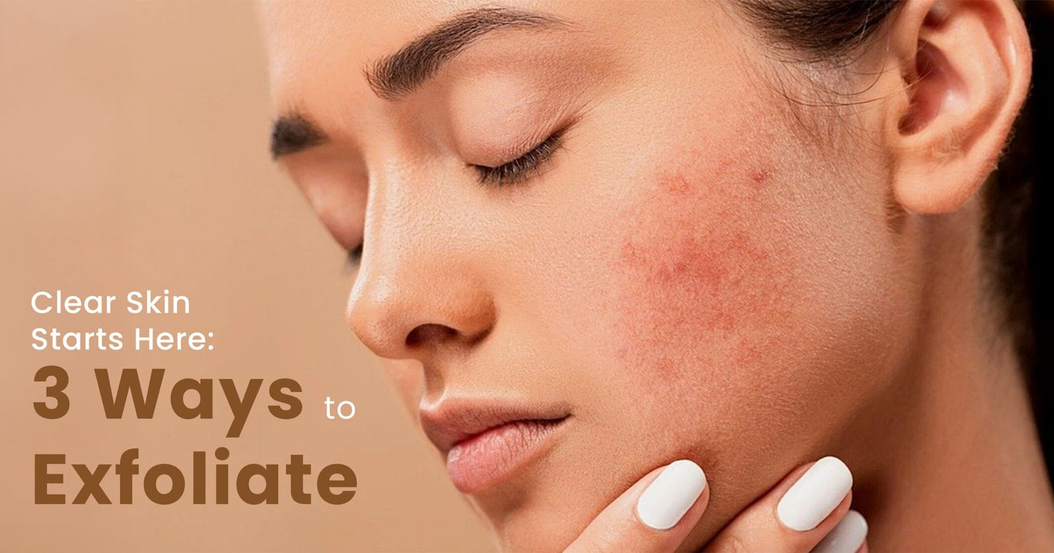 reasons for acne on face​
