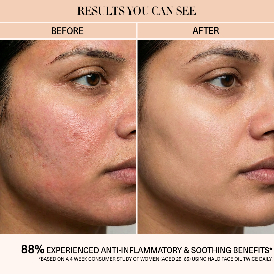 saffron oil inflammation before and after