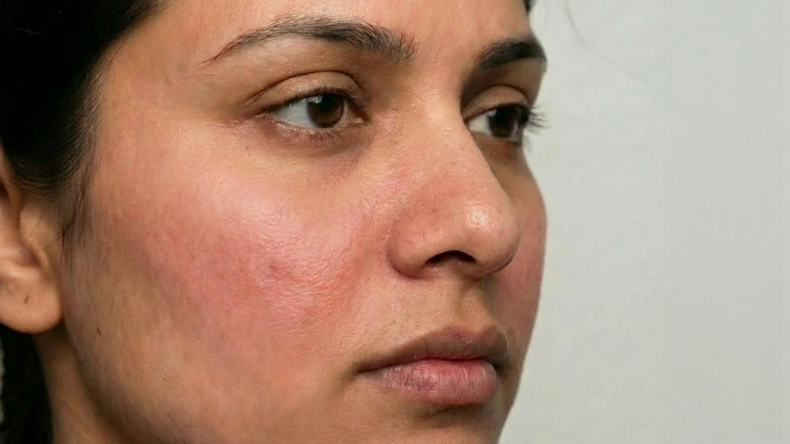 SKIN TEXTURE