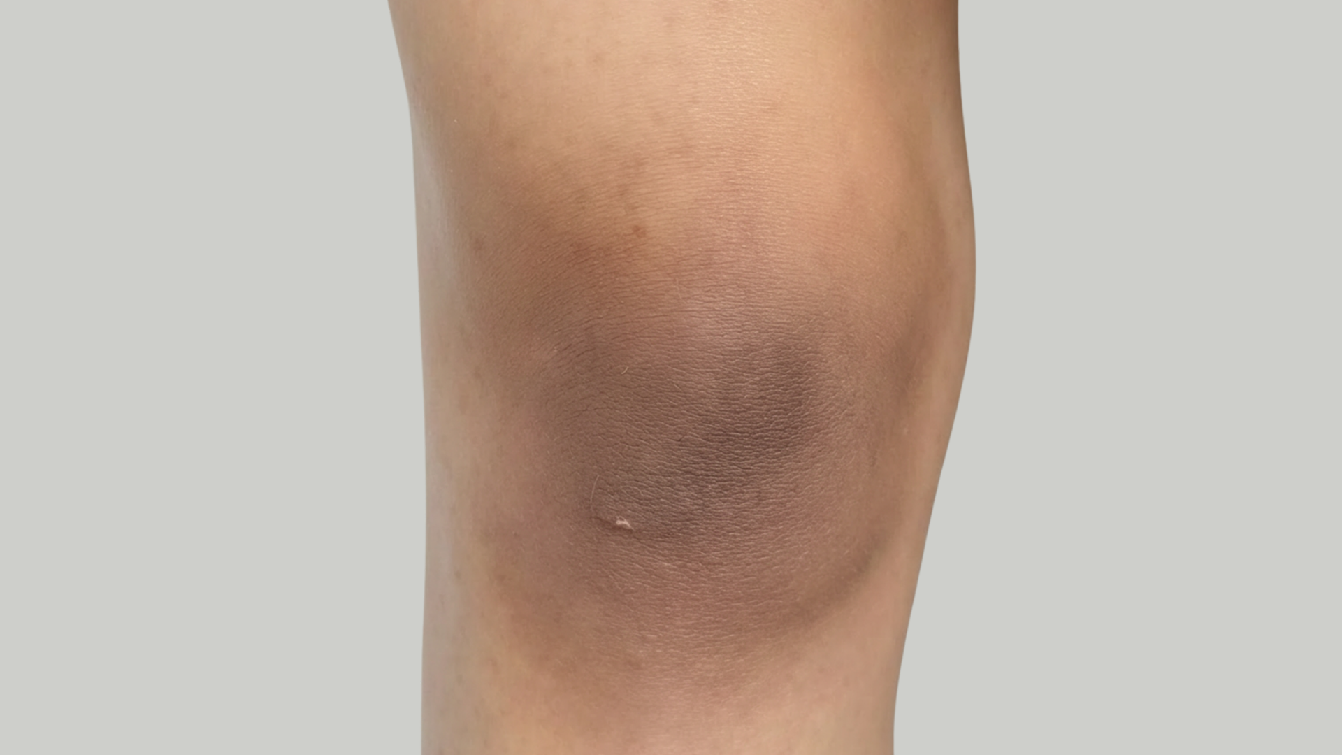 tan removal before and after​